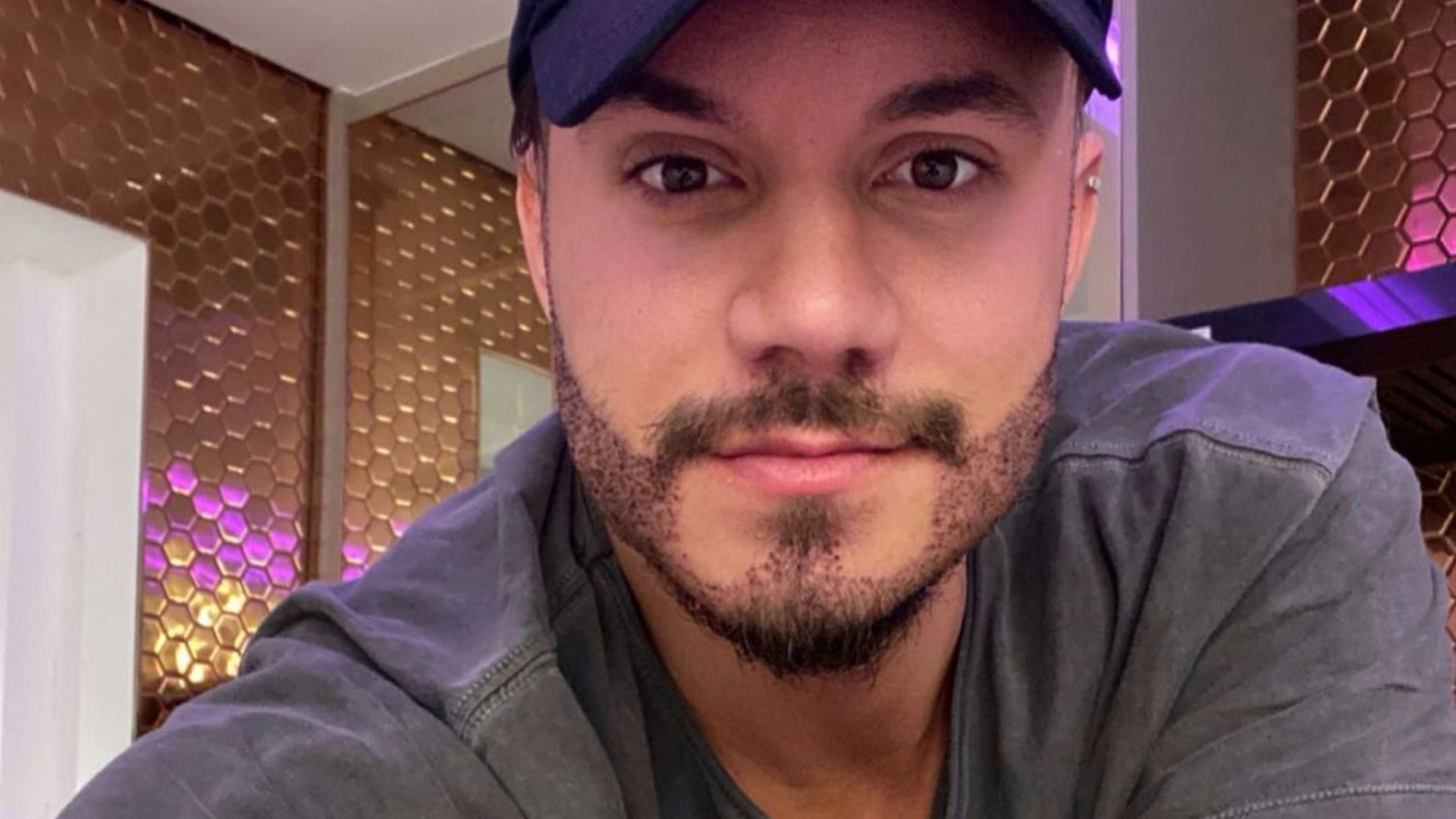 Ex-BBB Eliezer mostra resultado de transplante de barba sem curativos