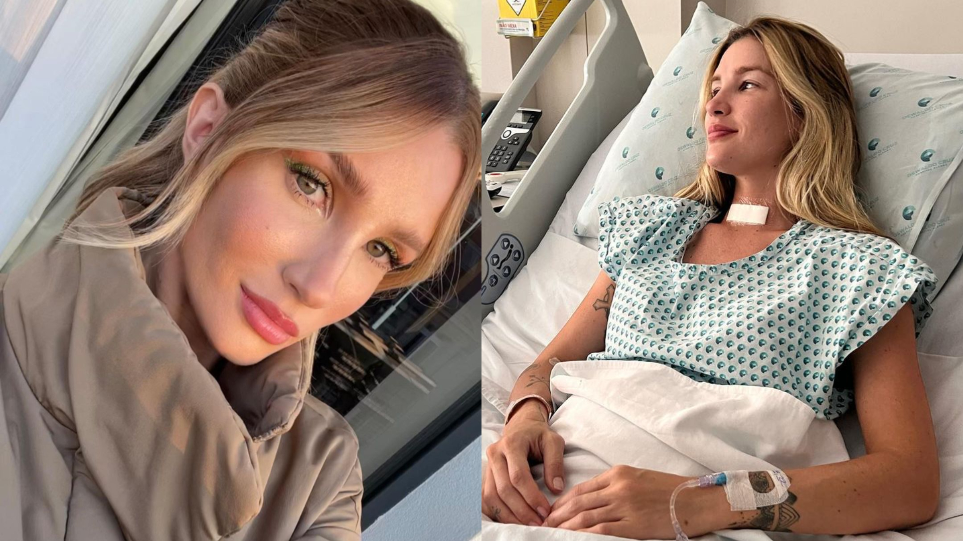 Ex-BBB Aline Gotschalg desabafa sobre câncer na tireoide: ”Receber esse diagnóstico não foi fácil”