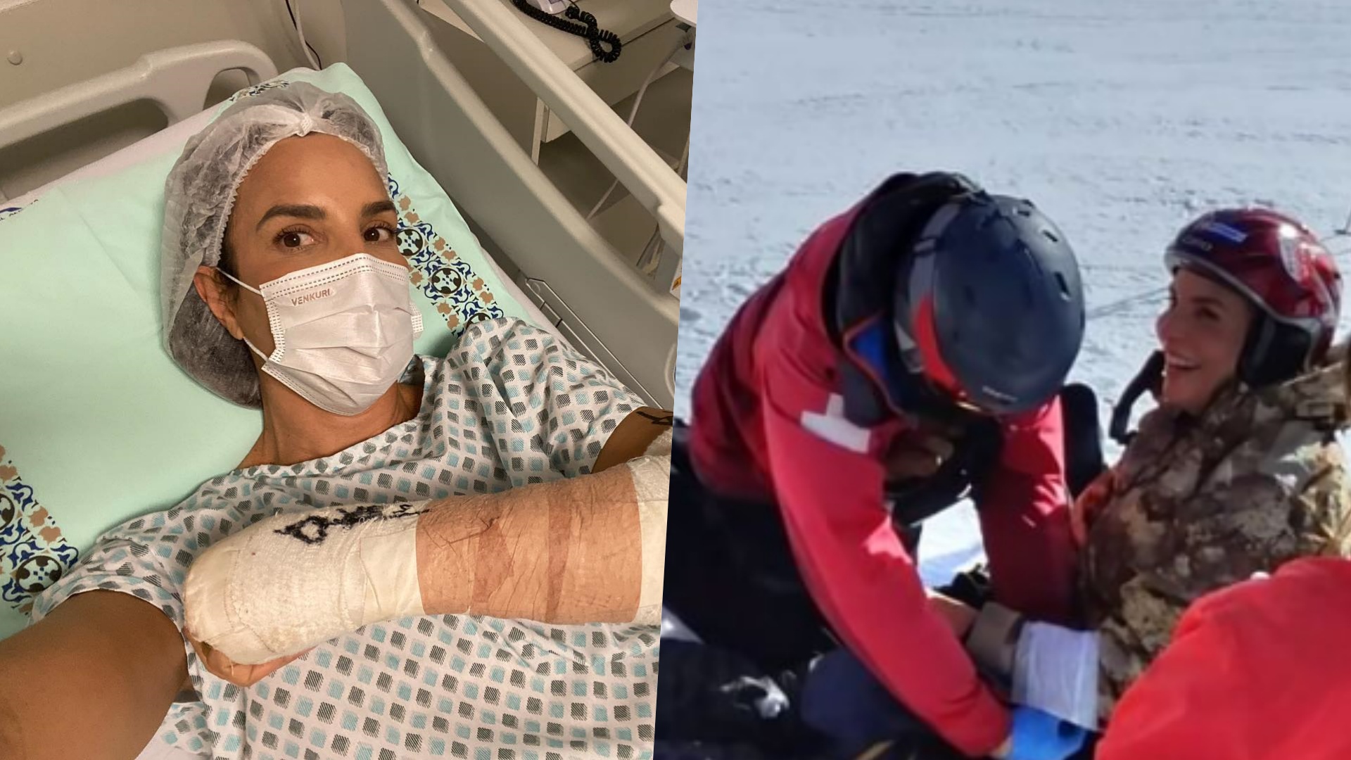 Ivete Sangalo posta vídeo de acidente esquiando: “Dor insuportável”