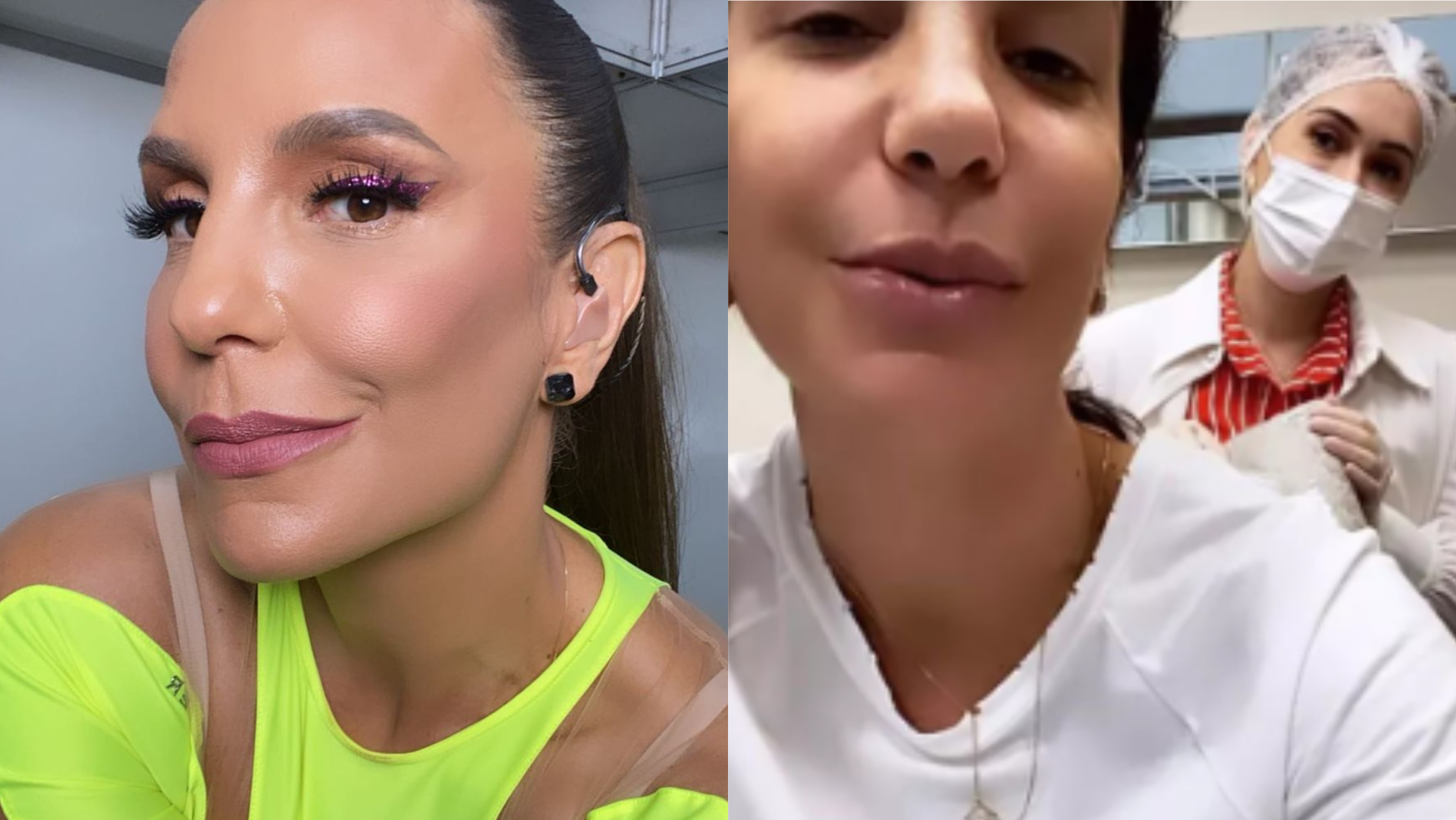 Ivete Sangalo faz tratamento após queda de cabelo por conta da covid-19