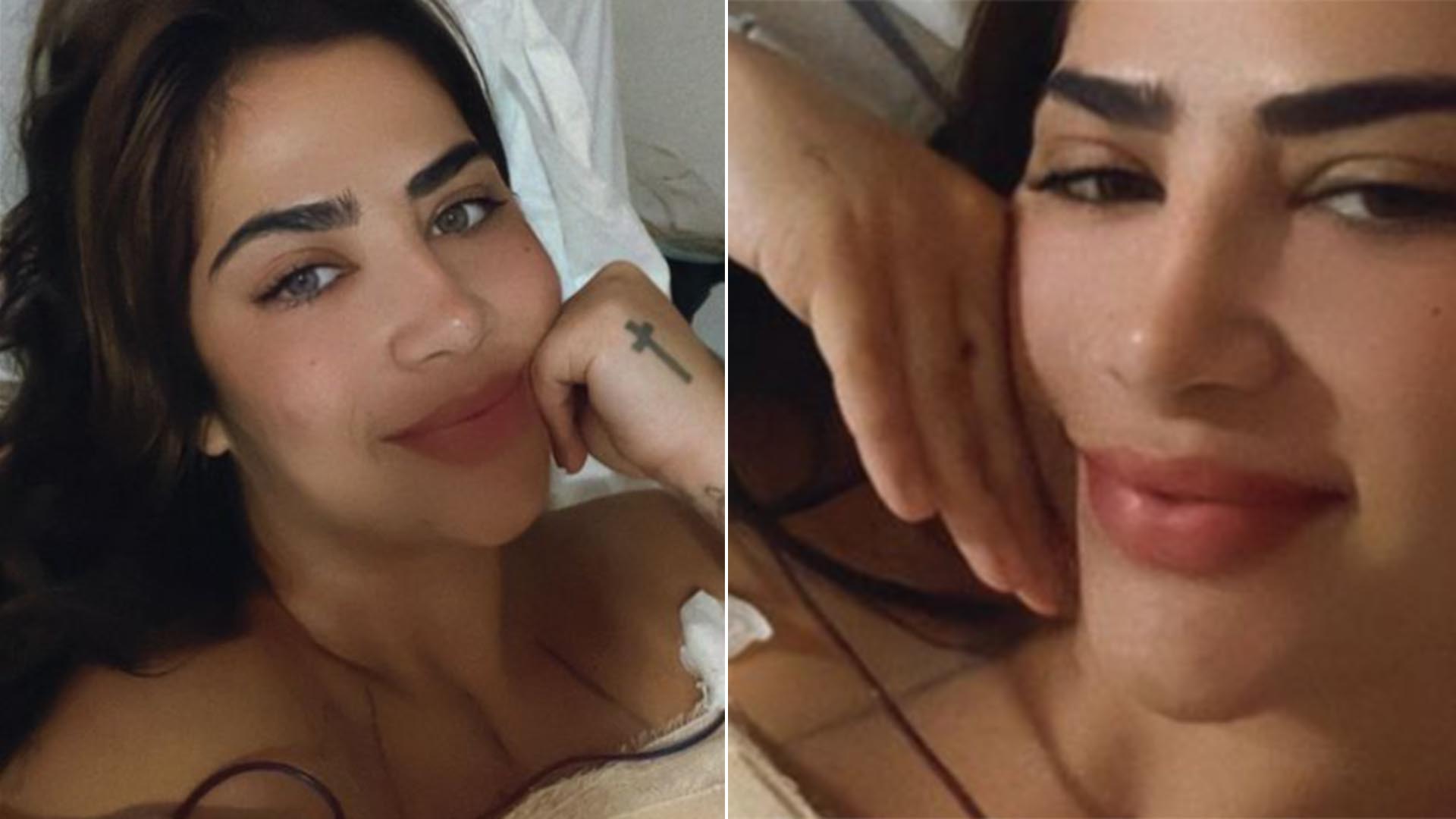Filha de Leonardo faz cirurgia plástica e diz: ‘Uma mulher mais confiante’