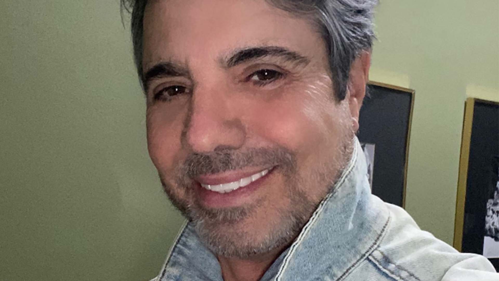 João Kleber faz harmonização facial e mostra fotos de antes e depois