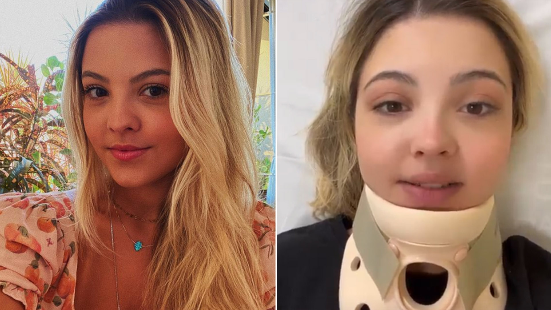 Julia Gomes fratura a coluna ao sofrer acidente