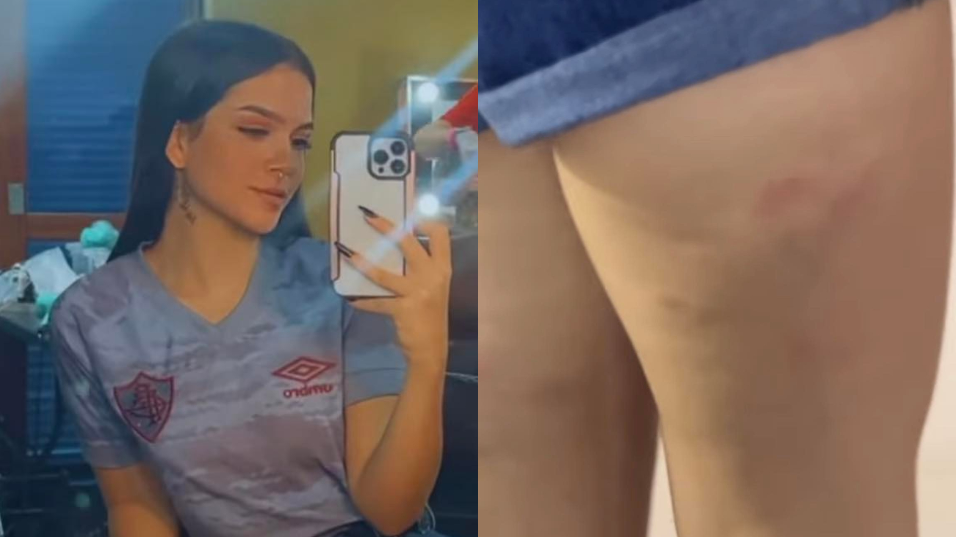 Mel Maia mostra picadas de mosquitos em gravação de novo filme: ”Bizarro”