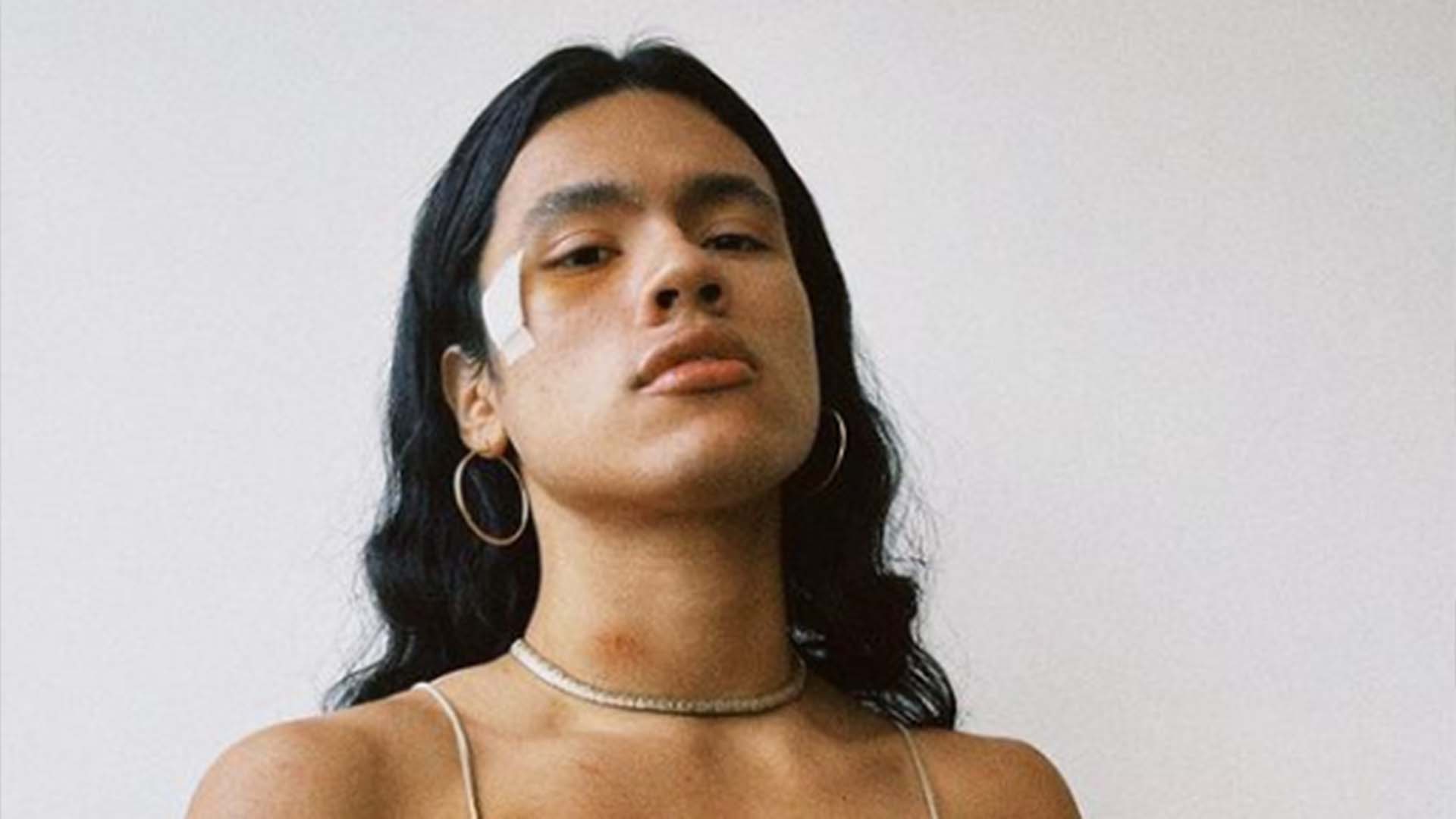 Modelo Sumé Yina revela que foi agredida: ‘Vítima de transfobia’