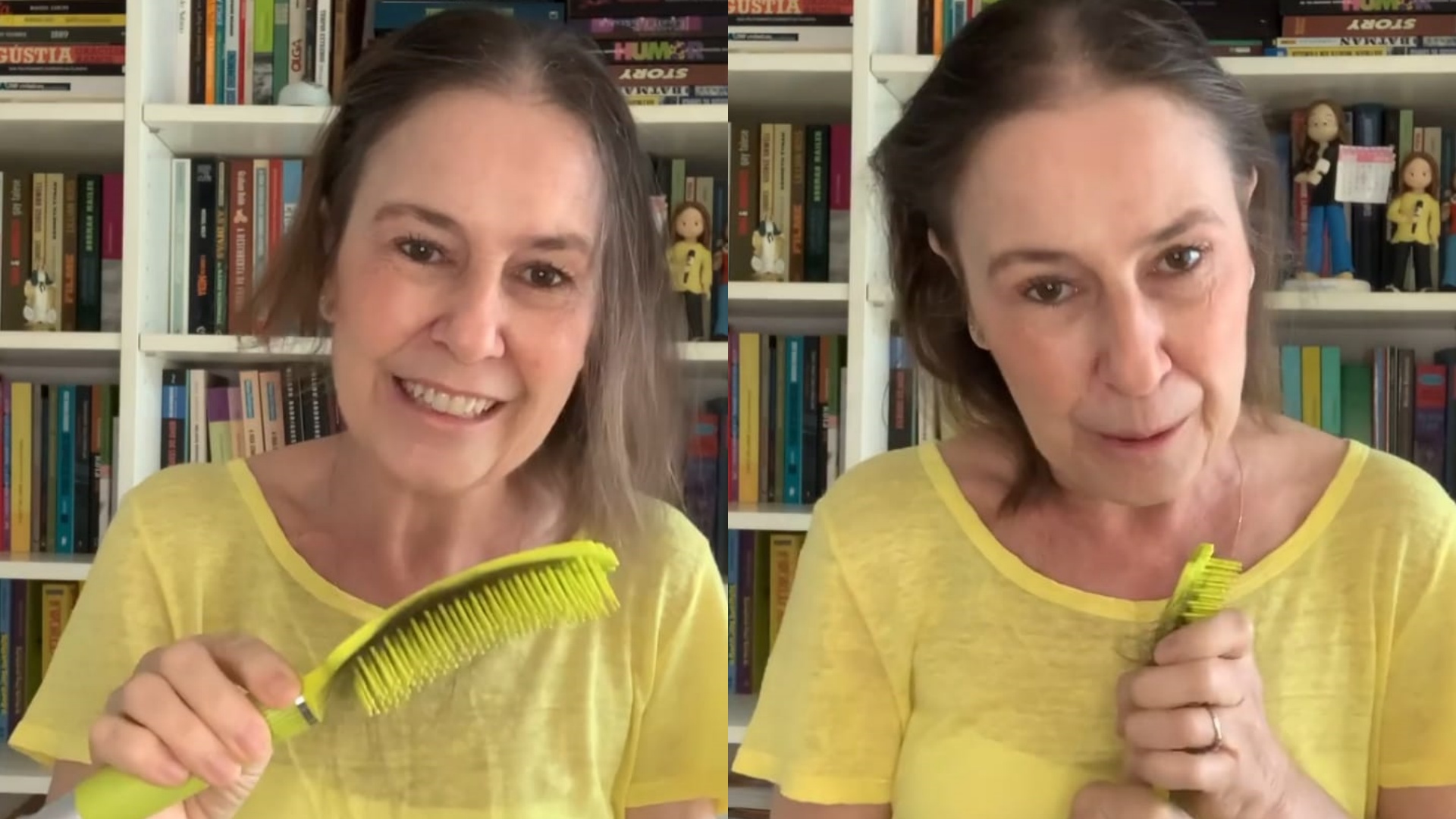 Em tratamento contra o câncer, Susana Naspolini mostra queda de cabelo: “Vou ter que raspar”