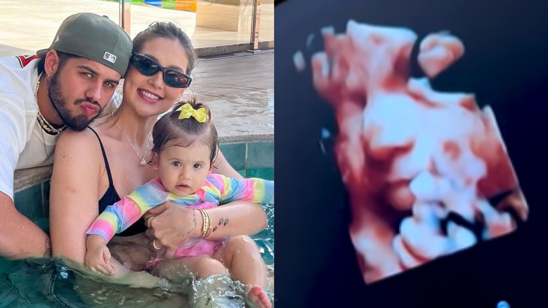 Grávida, Virginia Fonseca faz ultrassom 3D da filha e compara: ”Mesma coisa da Maria Alice!”