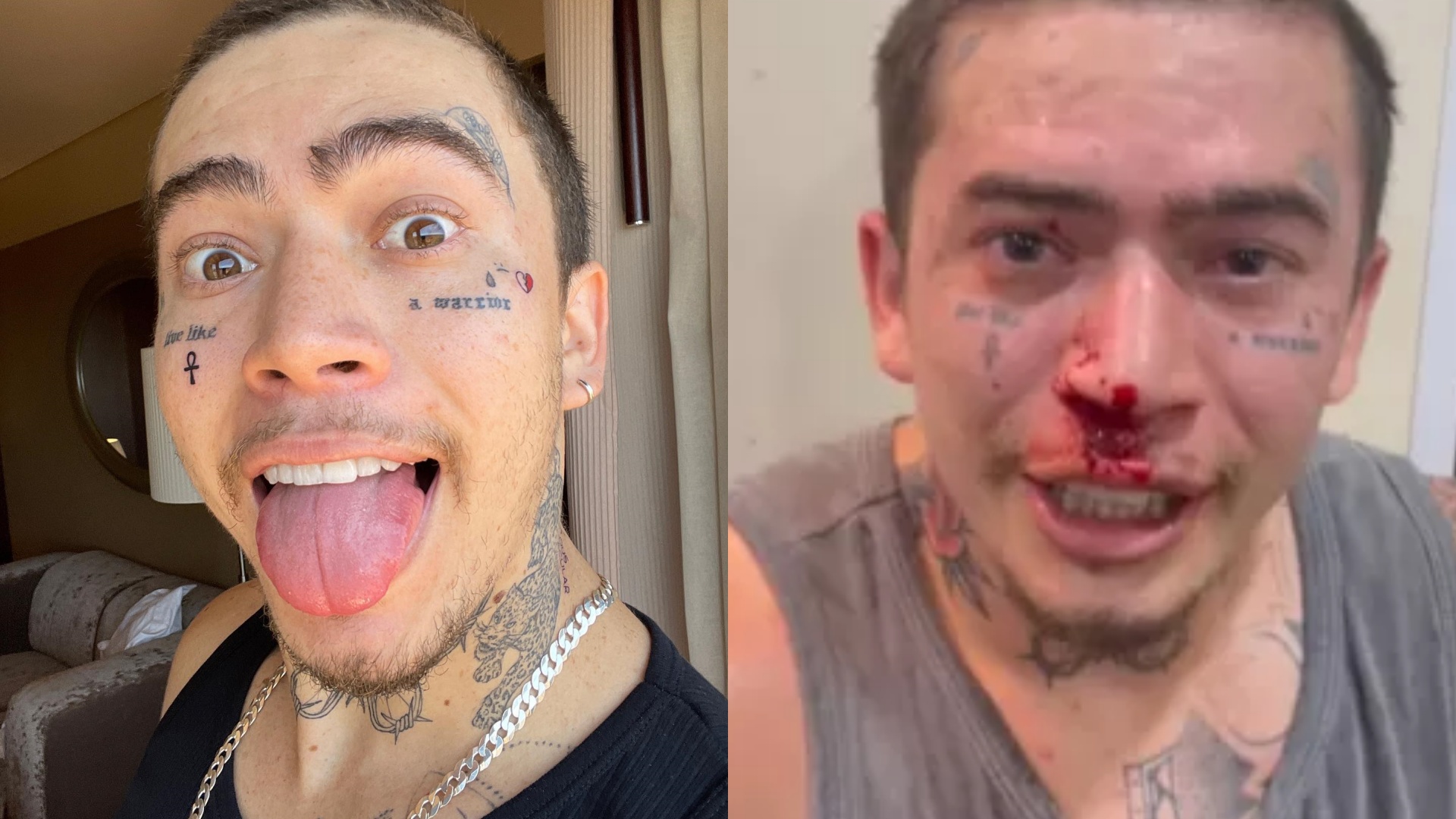 Whindersson Nunes surge com o rosto machucado após treino de luta: “Mexi com o cara errado”