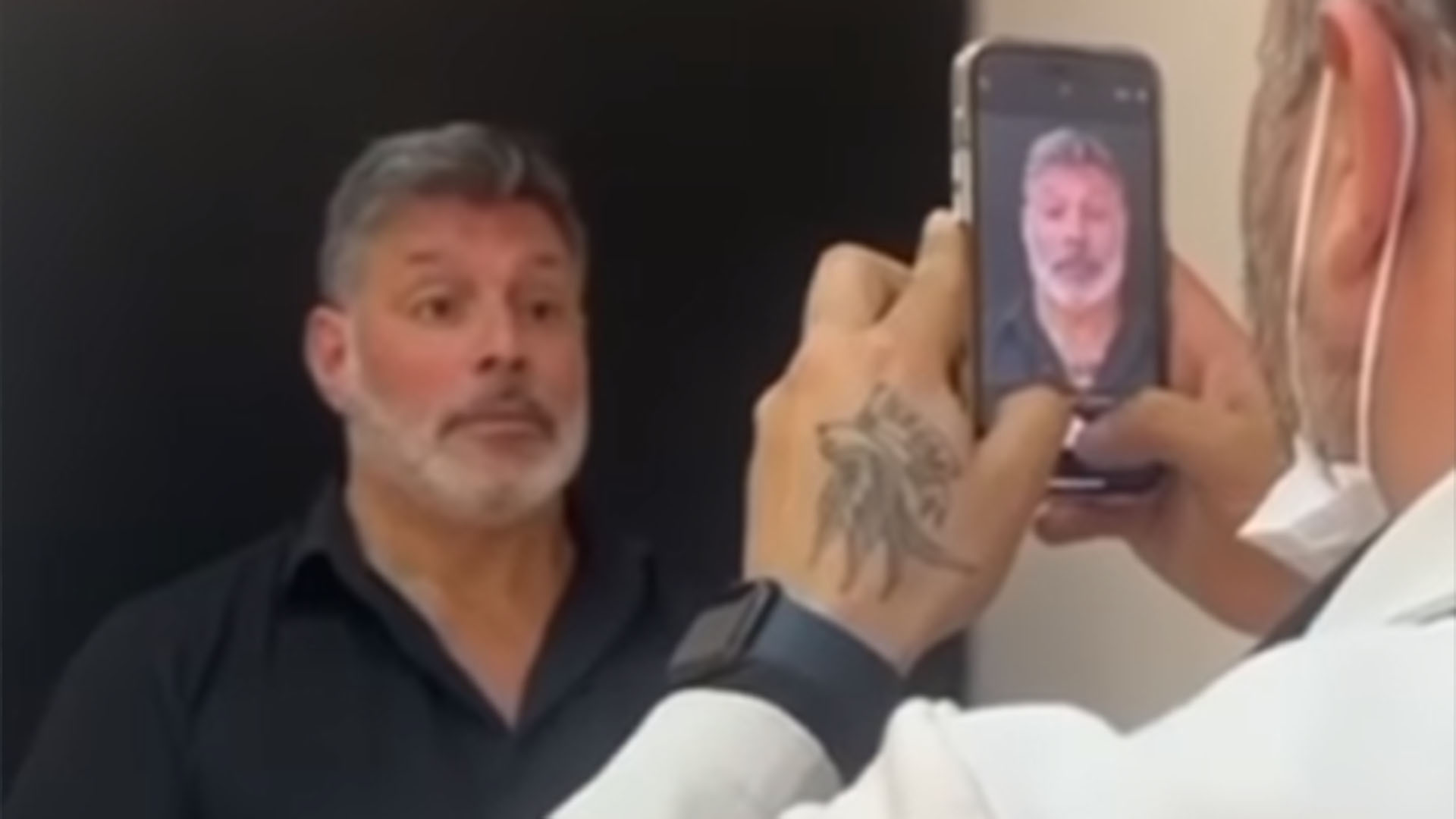 Alexandre Frota faz harmonização facial e exibe fotos de antes e depois