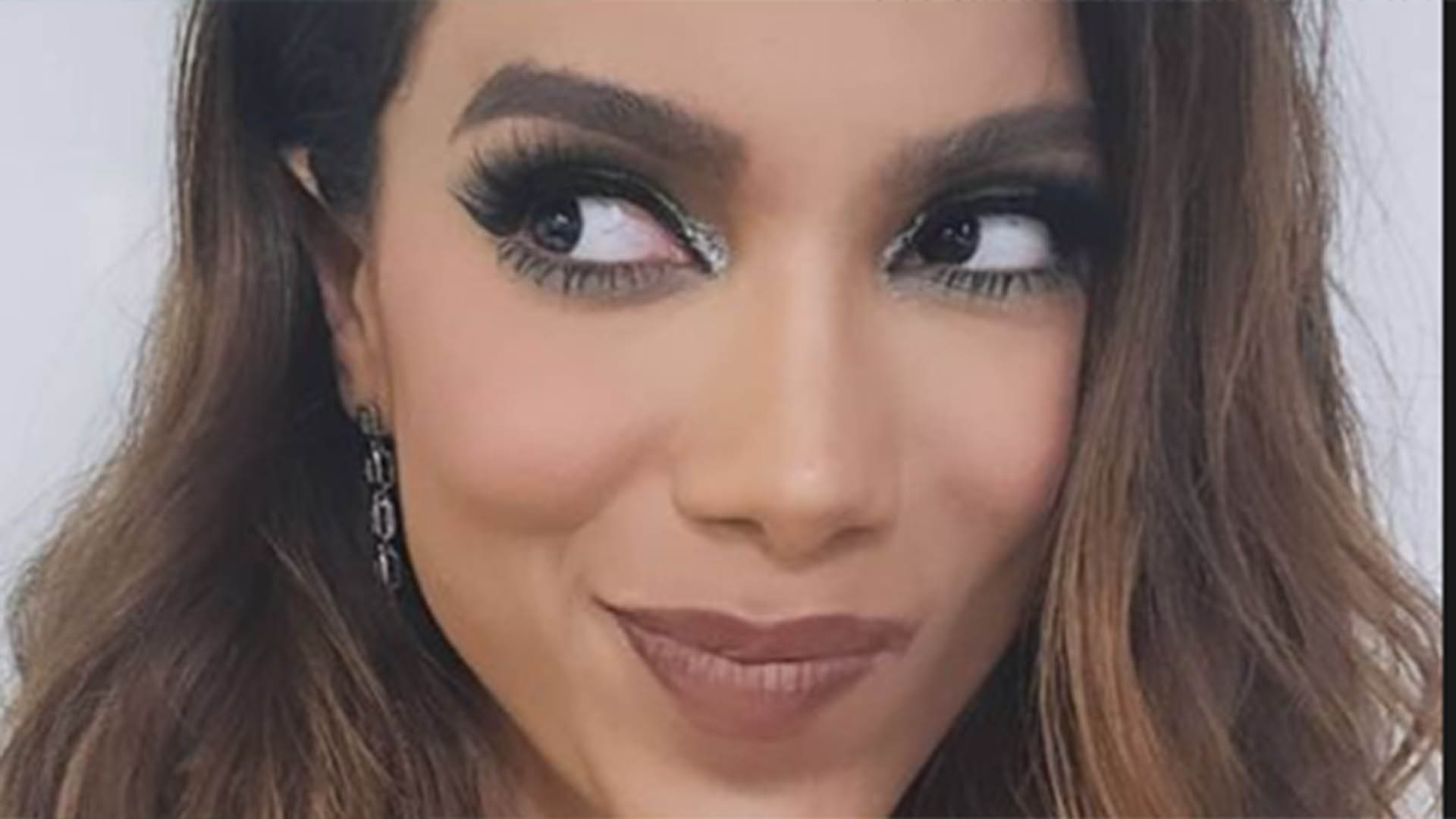 Anitta exibe hematoma na perna e explica o que aconteceu
