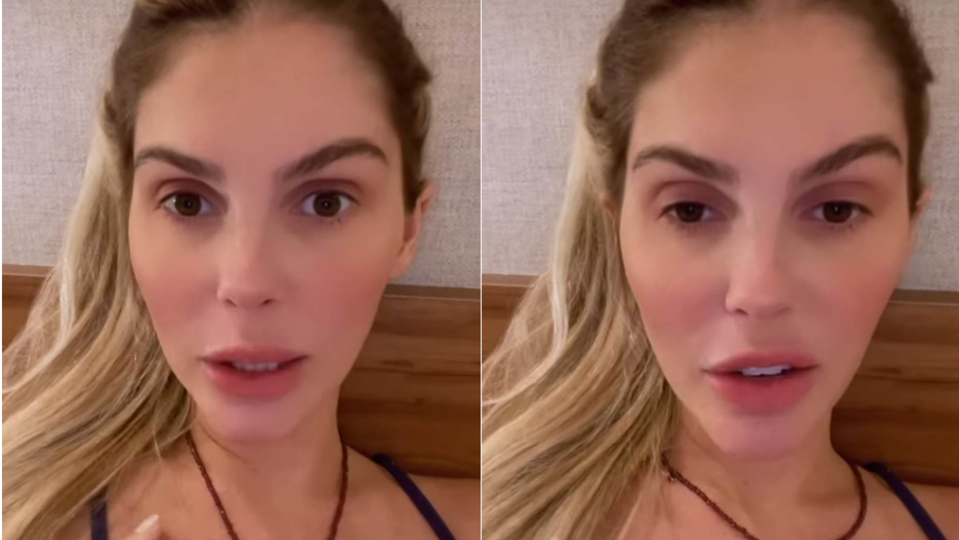 Após se casar, Bárbara Evans faz cirurgia de emergência: ”Doía demais”