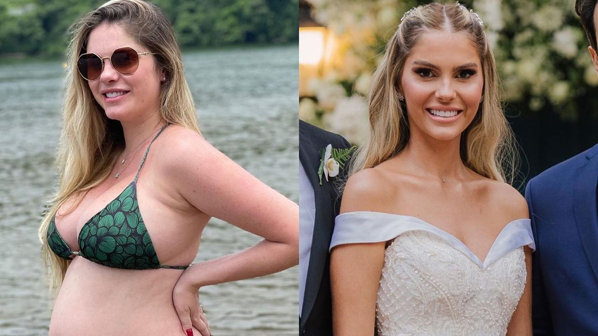 Hemorroida na gravidez é comum? Entenda a cirurgia de emergência de Bárbara Evans