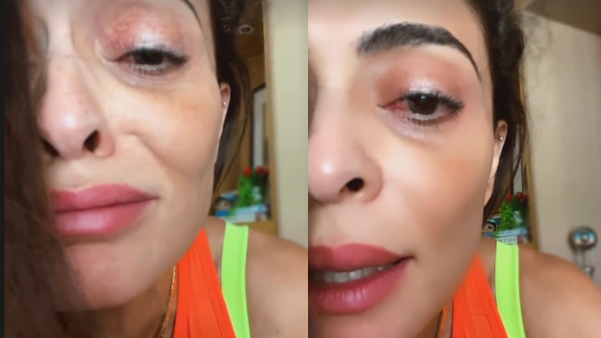 Juliana Paes surge com o olho inchado e lamenta: “Não vou poder”