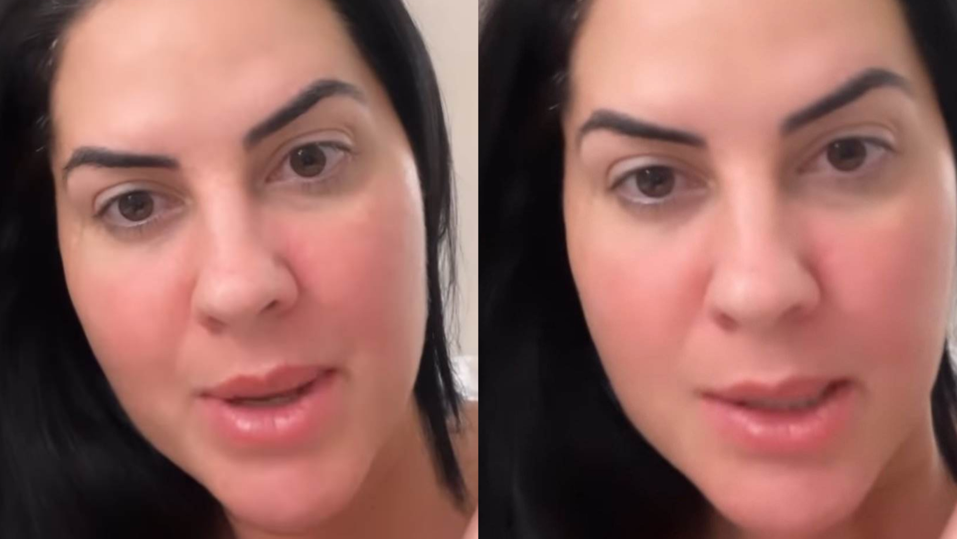 Graciele Lacerda revela se fez preenchimento na boca: ”Dando uma caidinha”