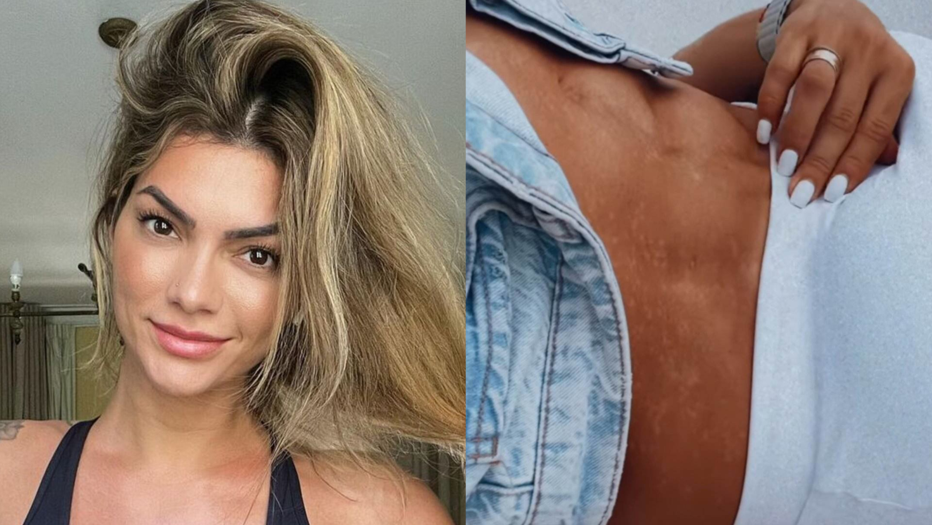 Kelly Key impressiona ao mostrar manchas de seu corpo: ”Um ano para voltar”