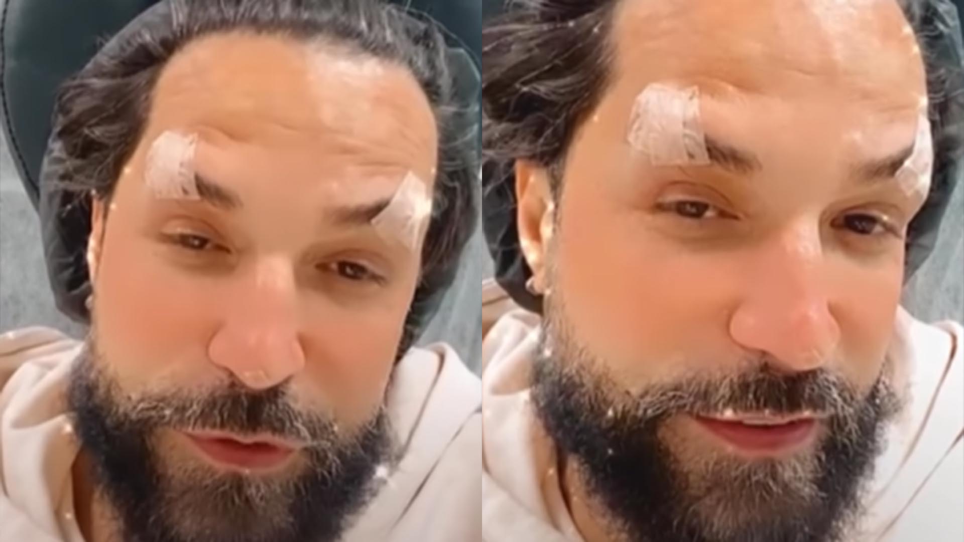 Latino rompe o silêncio após ser criticado por causa de procedimento no rosto