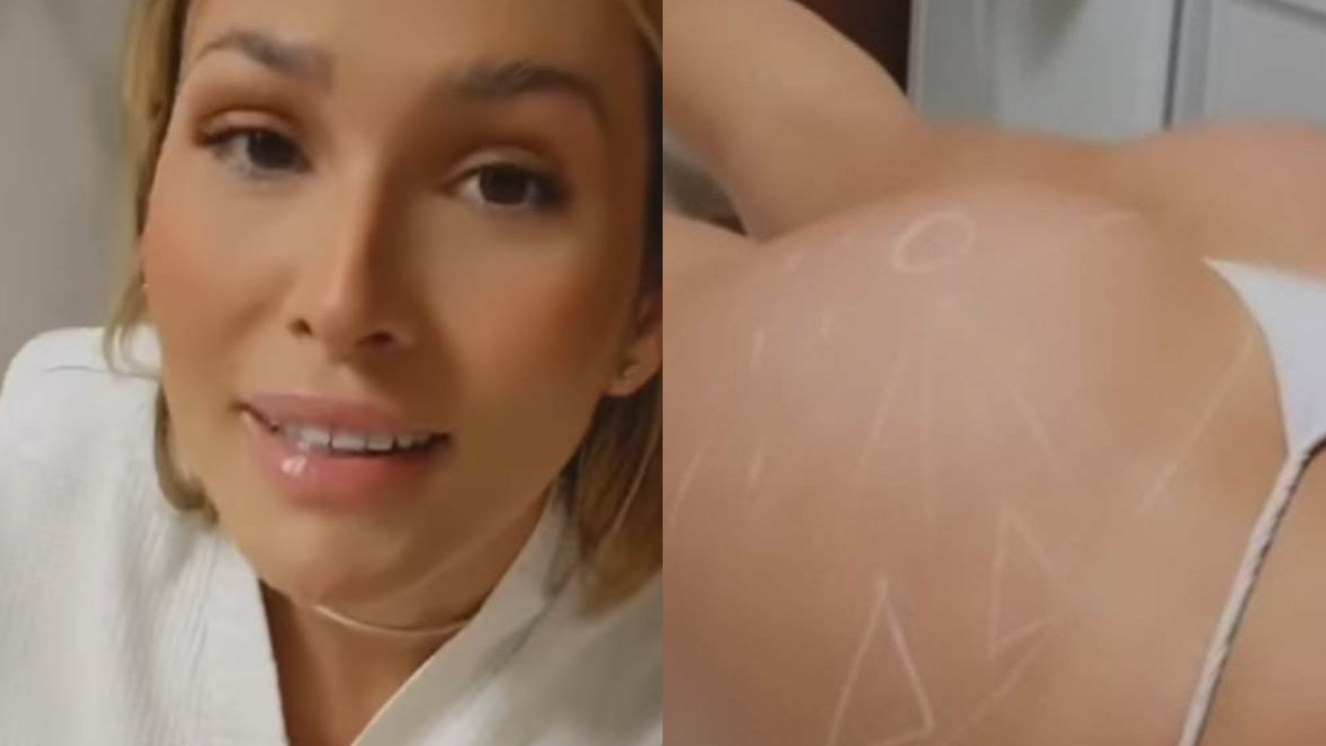 De calcinha mínima, Lívia Andrade exibe todo o bumbum ao fazer tratamento para empiná-lo