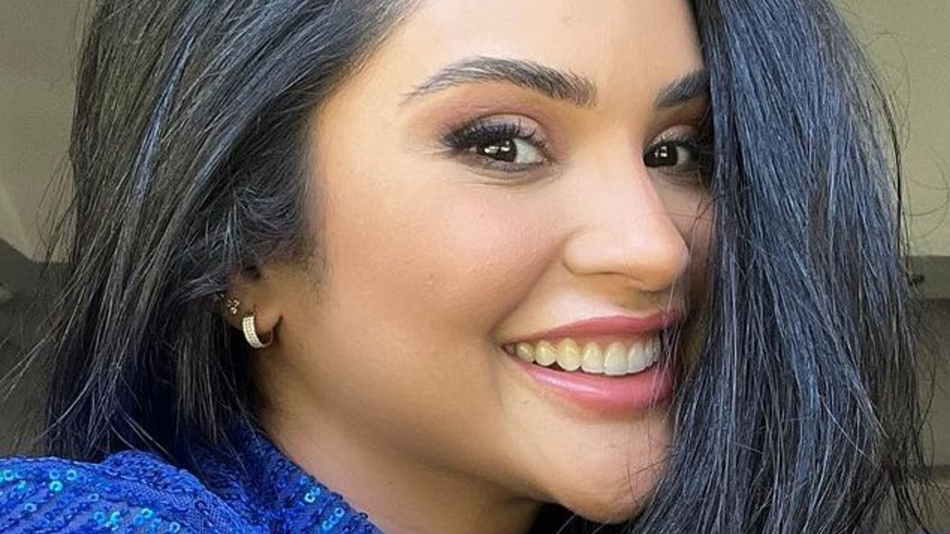 Mileide Mihaile mostra antes e depois de sua Lipo Lad