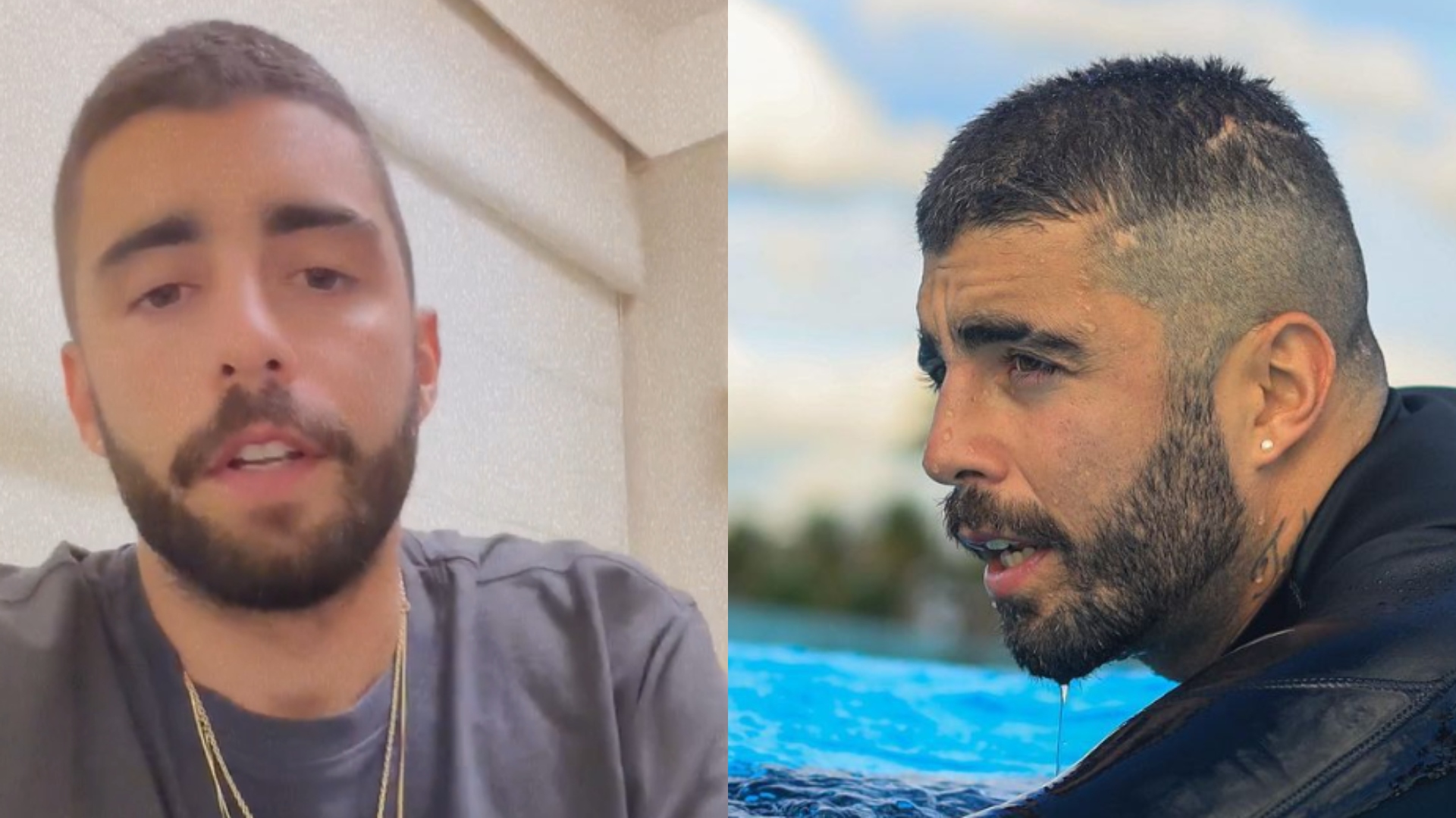Pedro Scooby revela que Aurora passou por cirurgia: ‘Momento delicado’