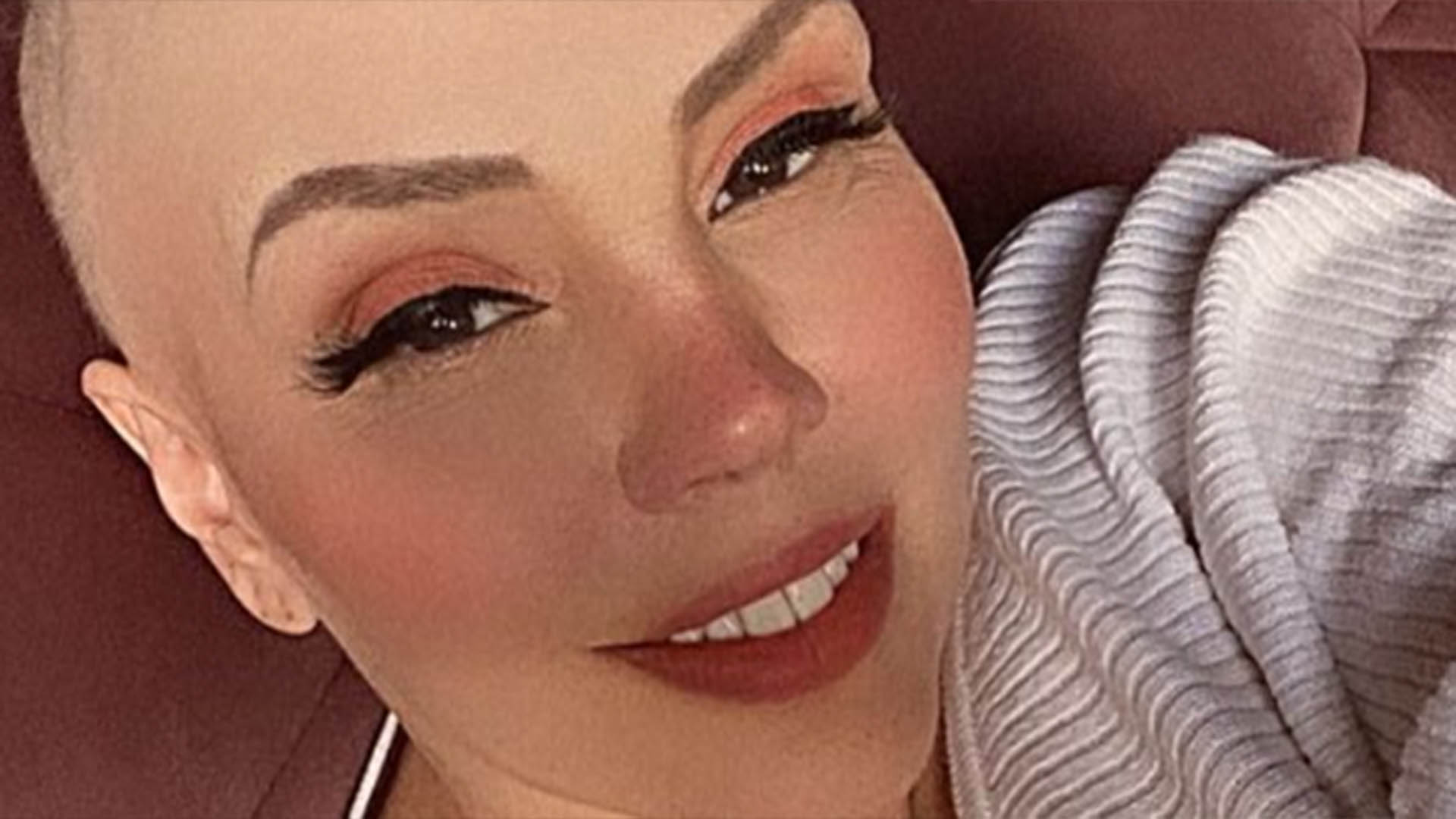 Simony faz selfie ao lutar contra o câncer: ‘Tratamento mais doloroso da minha vida’