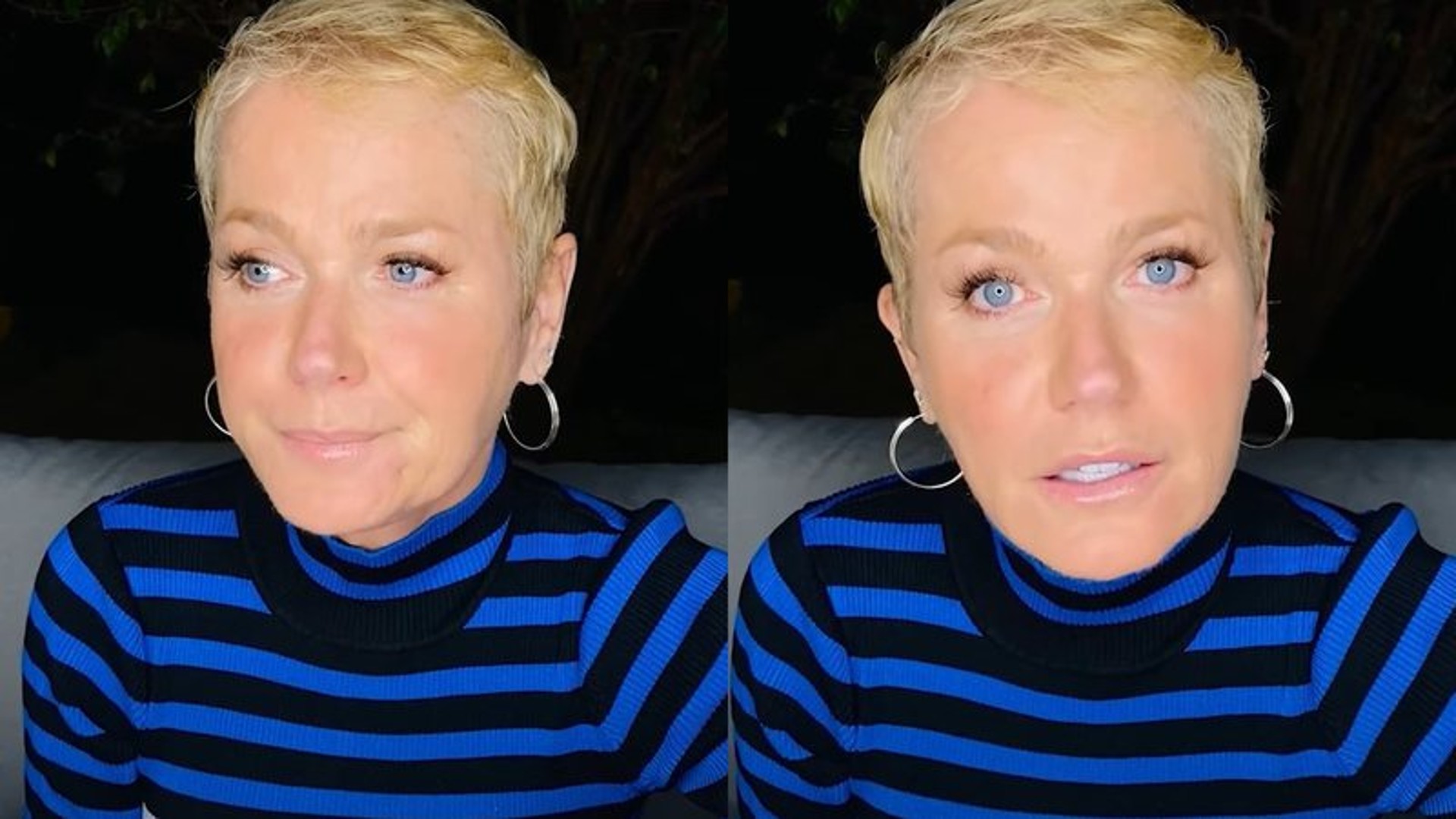 Xuxa atualiza estado de saúde após internação por procedimento estético