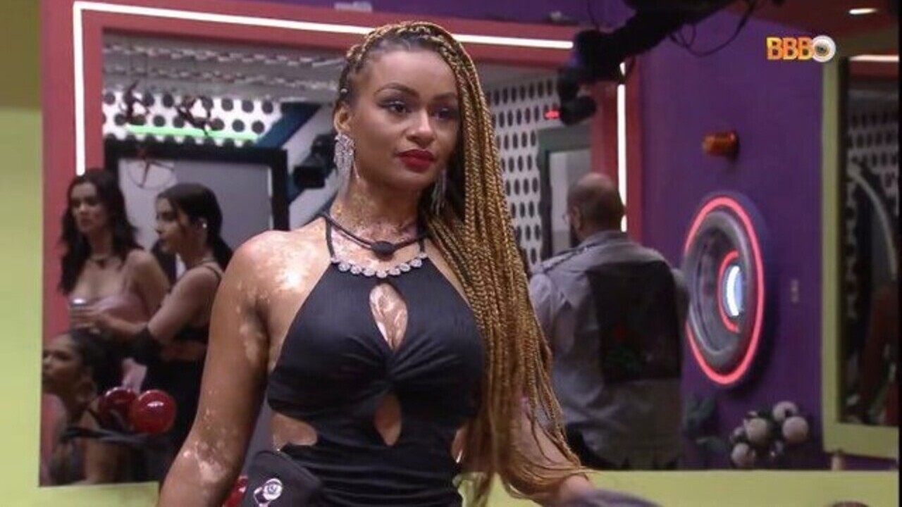 Natália do BBB22 fala sobre seu vitiligo: ”Meu cabelo era brancão”