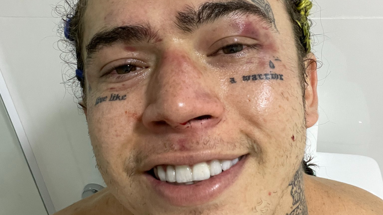 Whindersson Nunes desabafa após luta com Popó: ”O Brasil precisa do boxe”