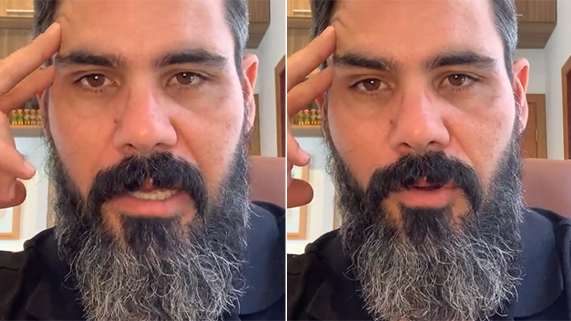 Juliano Cazarré conta sobre a recuperação da filha caçula, que está internada