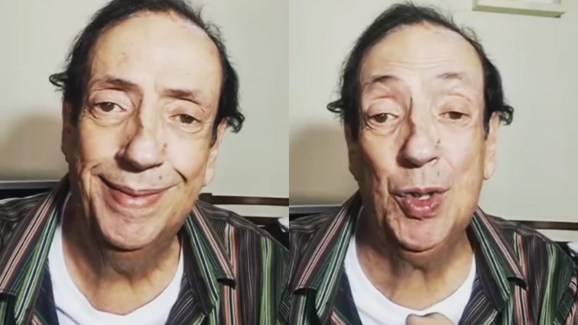 Marcos Oliveira, o Beiçola, revela que passará por cirurgia: “Torçam por mim”