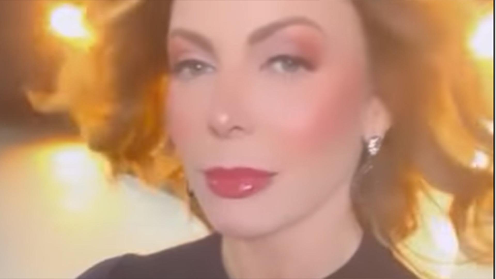 Sheila Mello mostra antes e depois de colocar botox