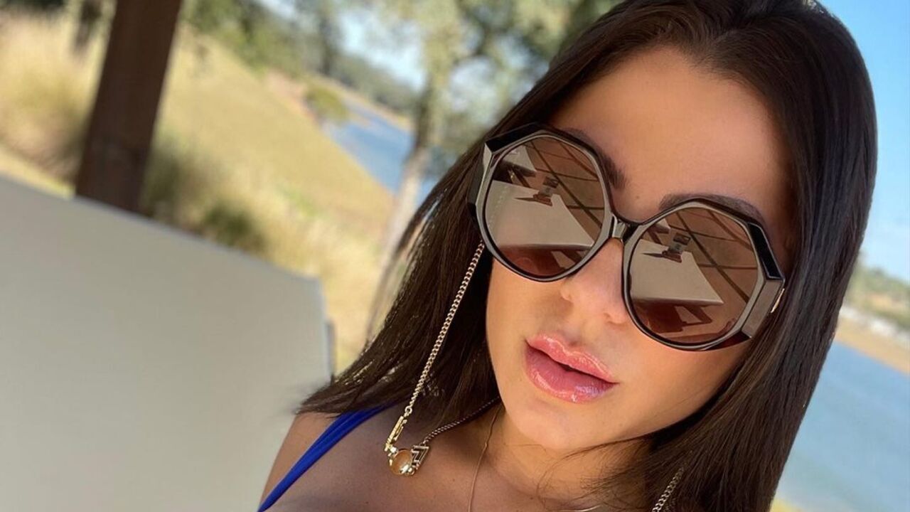 De biquíni, Andressa Ferreira exibe novo silicone marcado: ”Que maravilhosa”