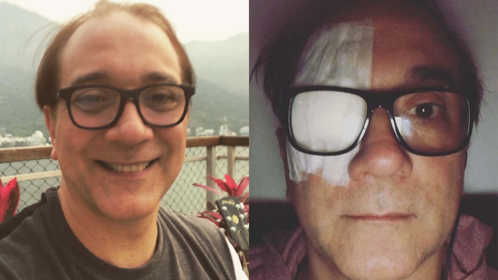 Vocalista da banda Biquíni Cavadão passa por cirurgia para retirar tumor