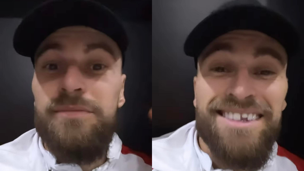 Jogador de futebol, Lucas Lima, quebra dente durante jogo do Fortaleza