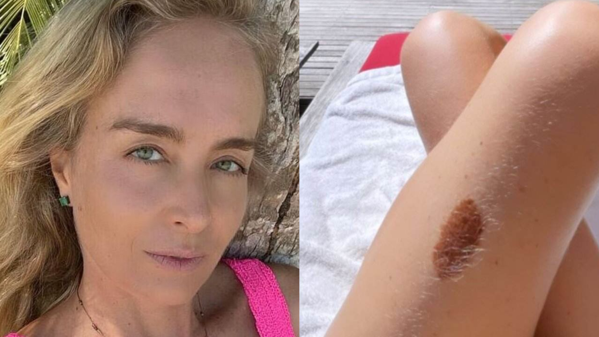 De biquíni, Angélica exibe pernas e chama a atenção com detalhe: ”Pinta pra jogo”