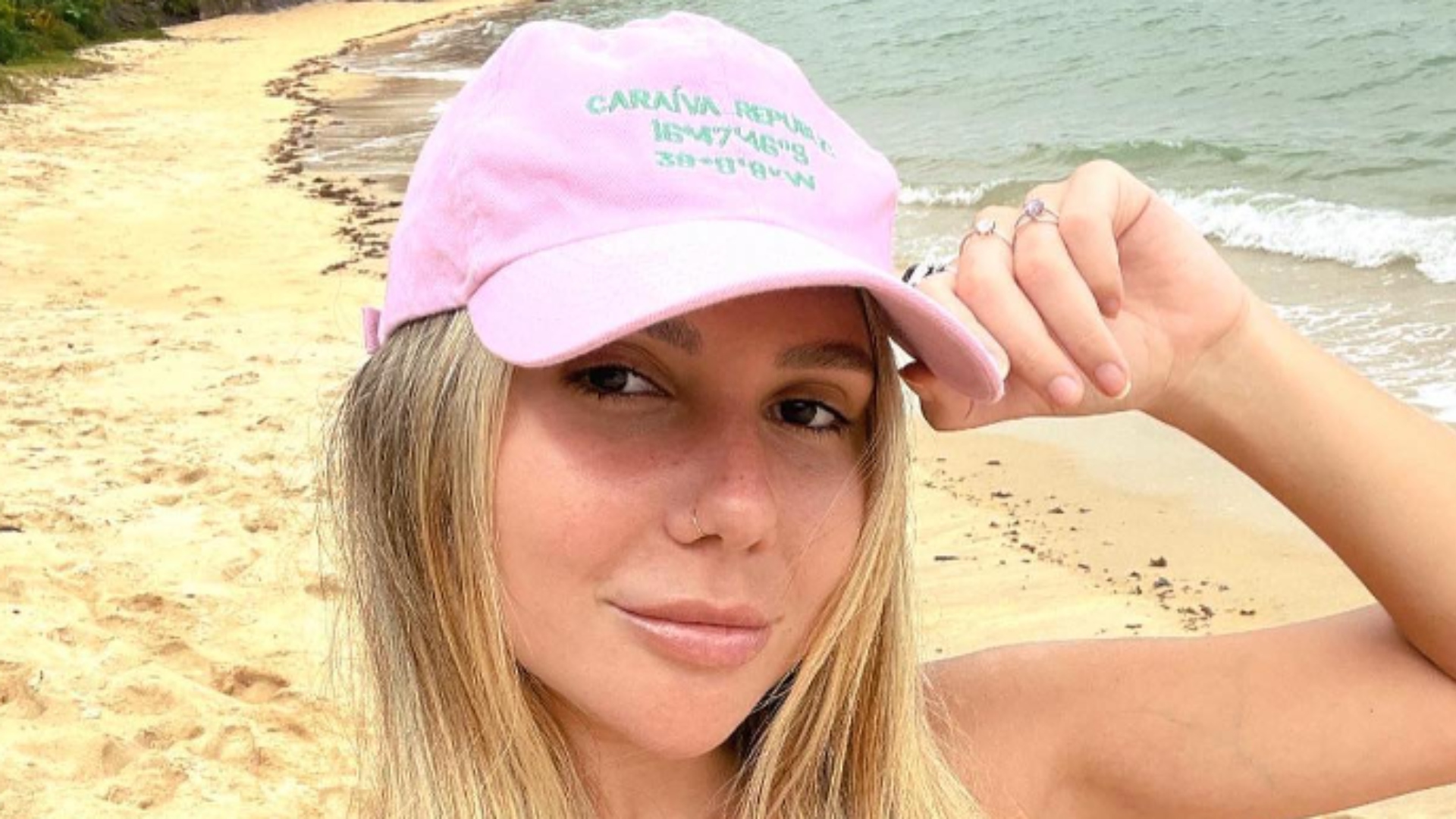 Médico alerta sobre doença de filha de Renato Gaúcho: ‘Condição neurológica’