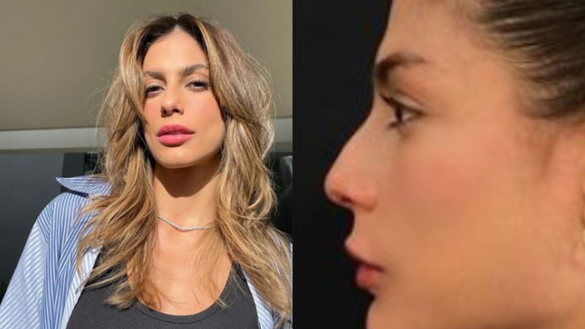 Mari Gonzalez impressiona ao mostrar antes e depois de procedimento estético