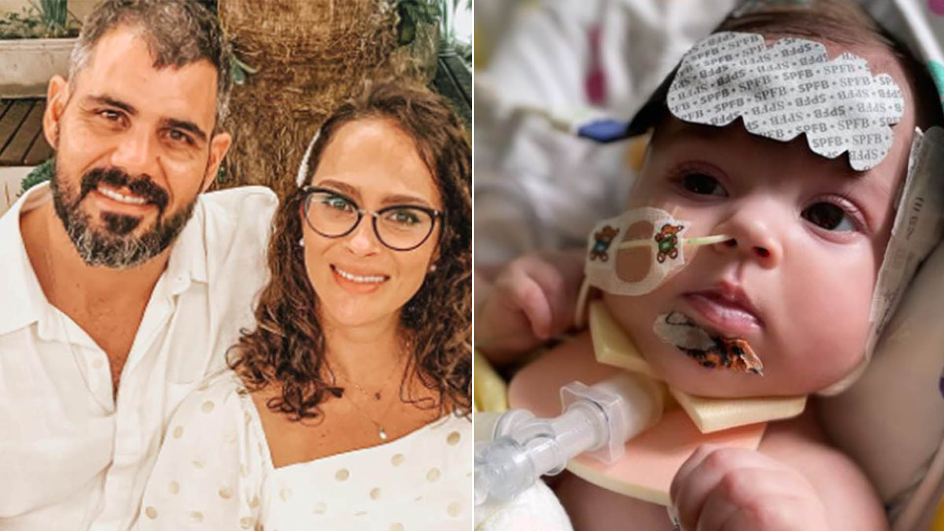 Entenda condição rara de filha de Juliano Cazarré; bebê já ficou internada por 6 meses