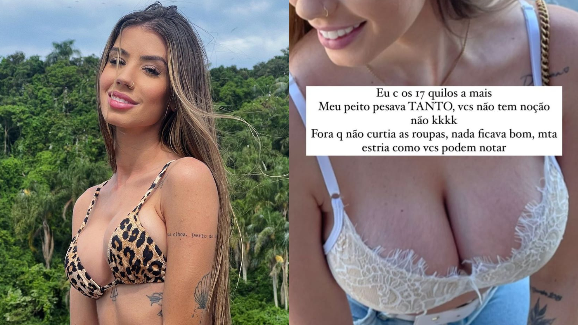 Maria Lina, ex de Whindersson Nunes, mostra antes e depois de procedimento nos seios