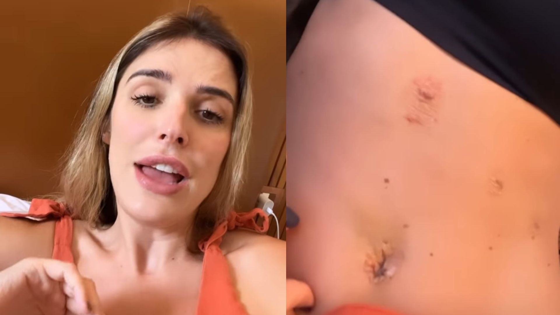 Rafa Brites fala sobre cirurgias e mudança no umbigo: ‘Parece outra barriga’