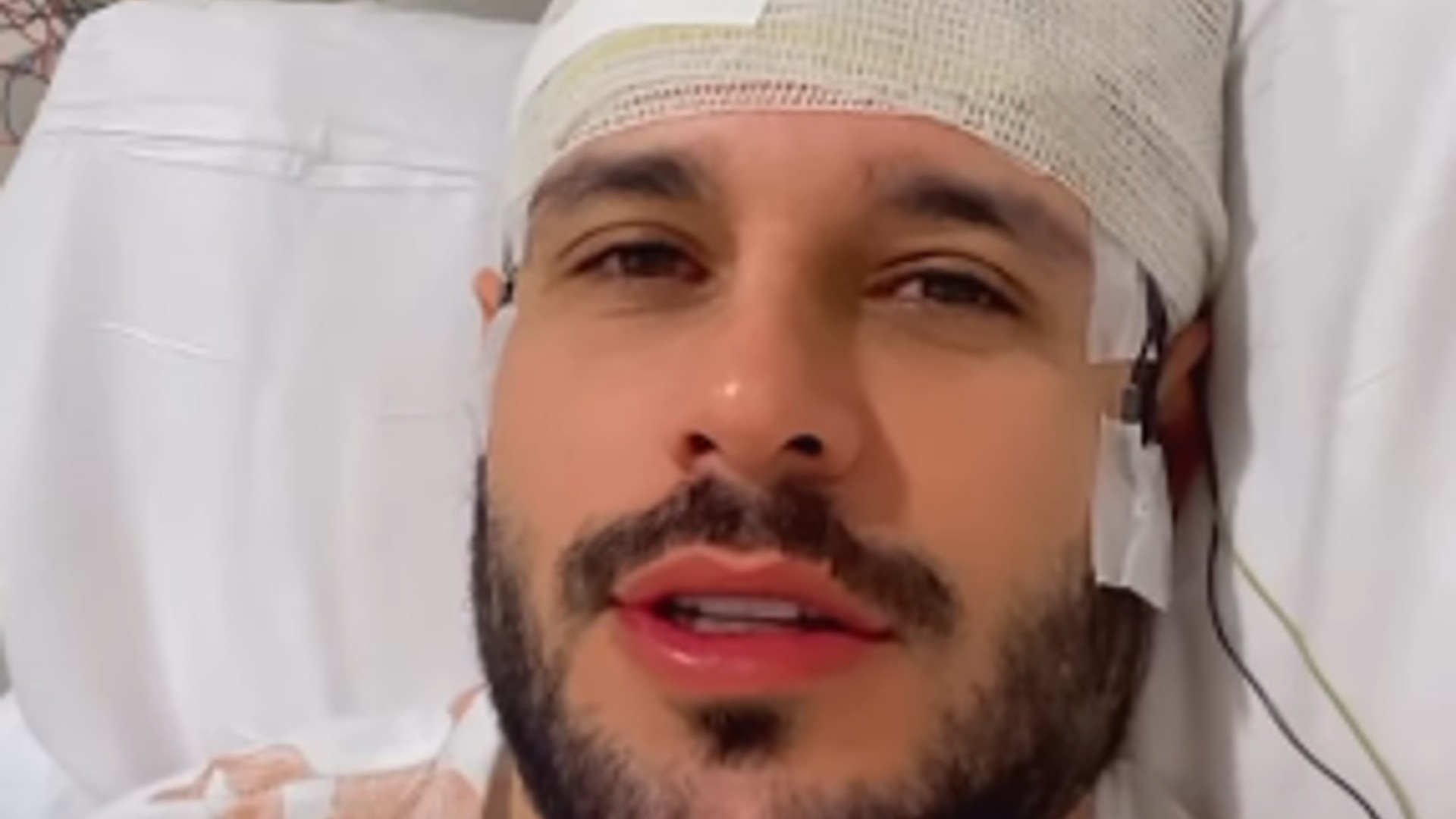 Após acidente, ex-BBB Rodrigo Mussi assusta ao fazer exame cerebral