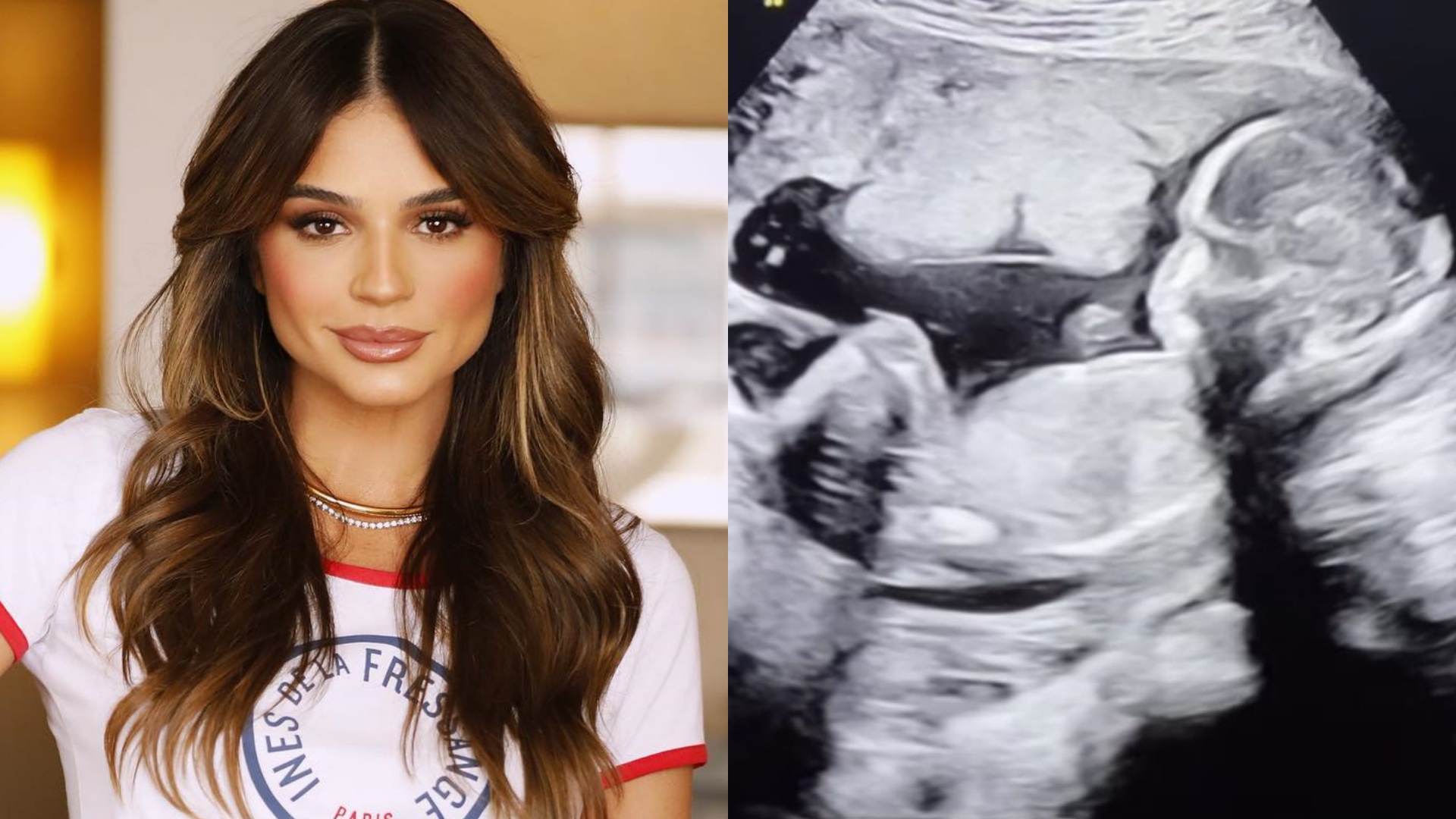 Thássia Naves anuncia nome do primeiro filho ao mostrar ultrassom