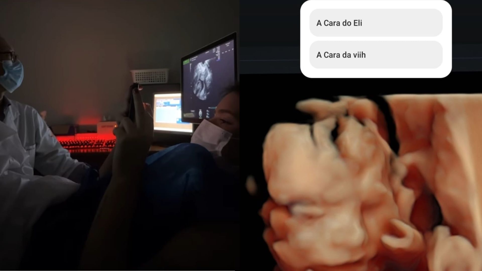 Viih Tube mostra aos seguidores ultrassom 3D da filha Lua pela primeira vez