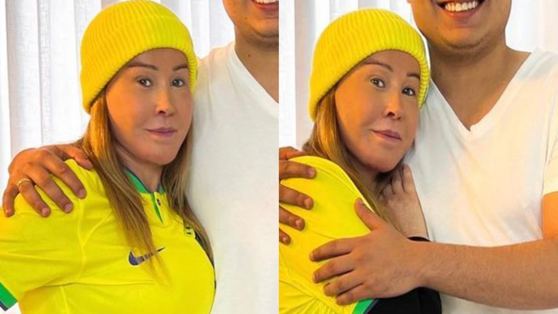 Zilu Camargo reaparece na rede social e explica inchaço no rosto: ”Cirurgia”