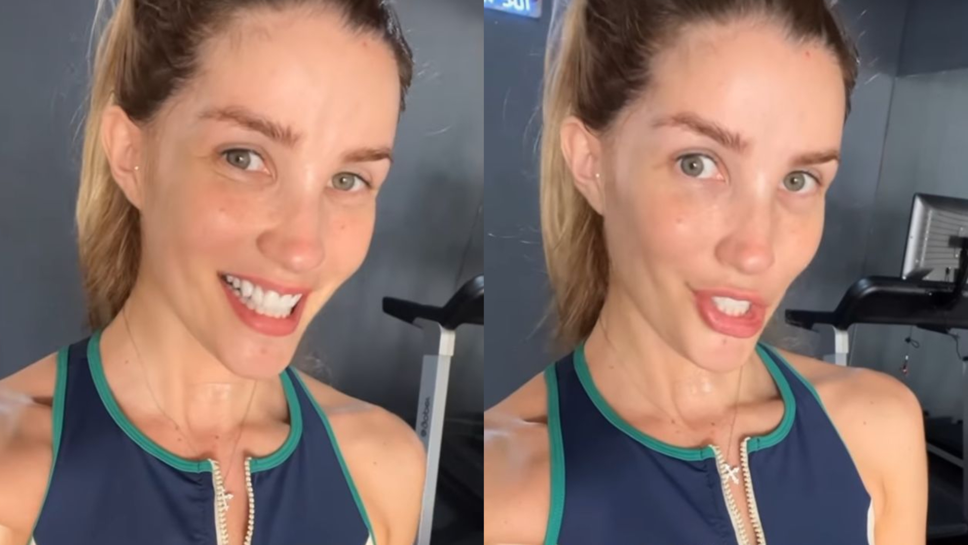 Aline Gotschalg celebra volta da fala após paralisia das cordas vocais