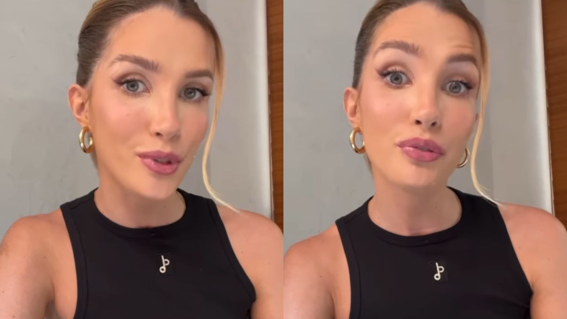 Ex-BBB Aline Gotschalg desabafa sobre câncer e perda da voz: ”Tinha tanto medo de morrer”