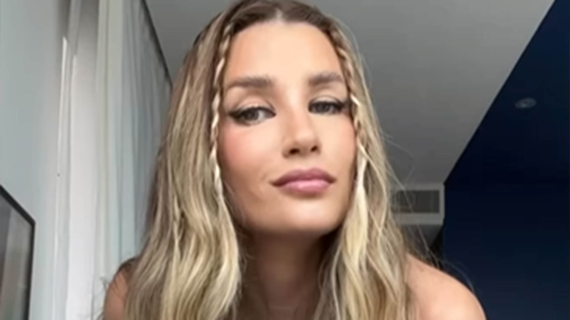 Ex-BBB Aline Gotschalg revela problema de saúde após retirar câncer
