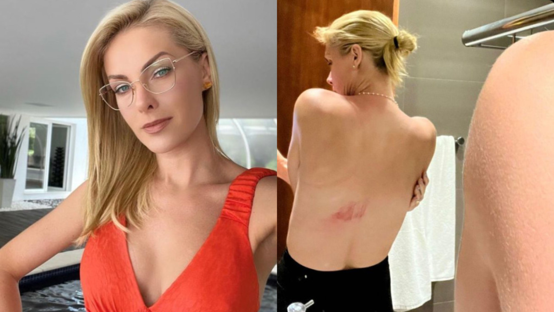 Ana Hickmann sofre acidente com cavalo e machuca as costas: “Fiquei sem ar”