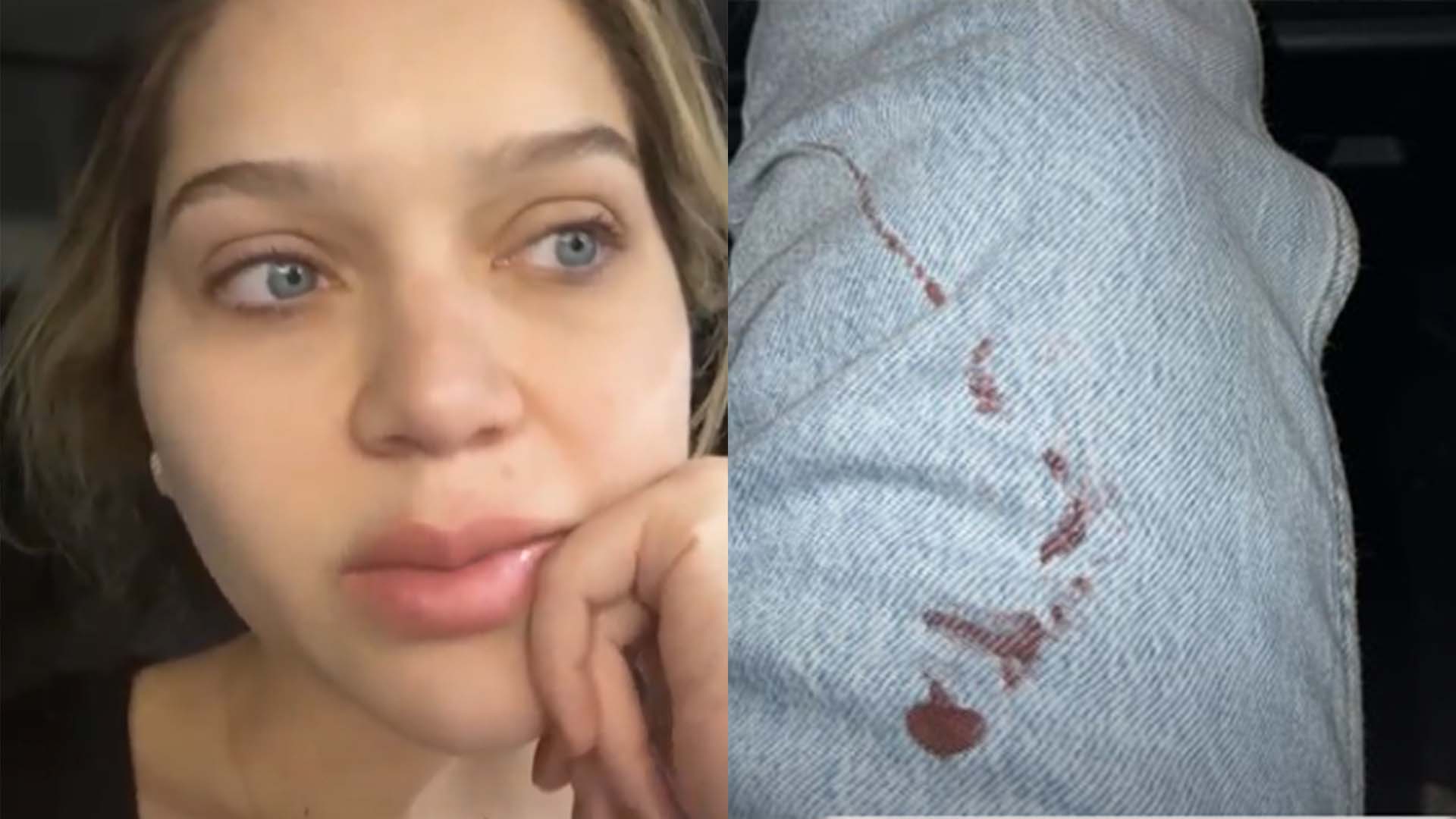 Filha do cantor Leandro revela susto com acidente doméstico