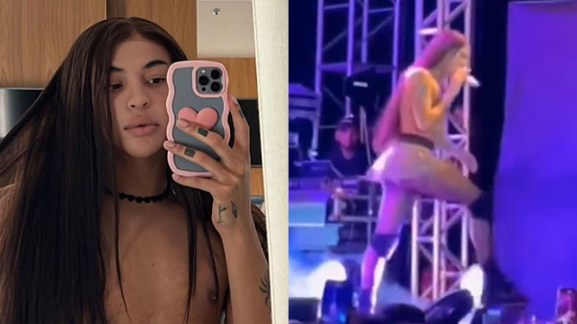 Pabllo Vittar leva tombo no palco e mostra arranhão