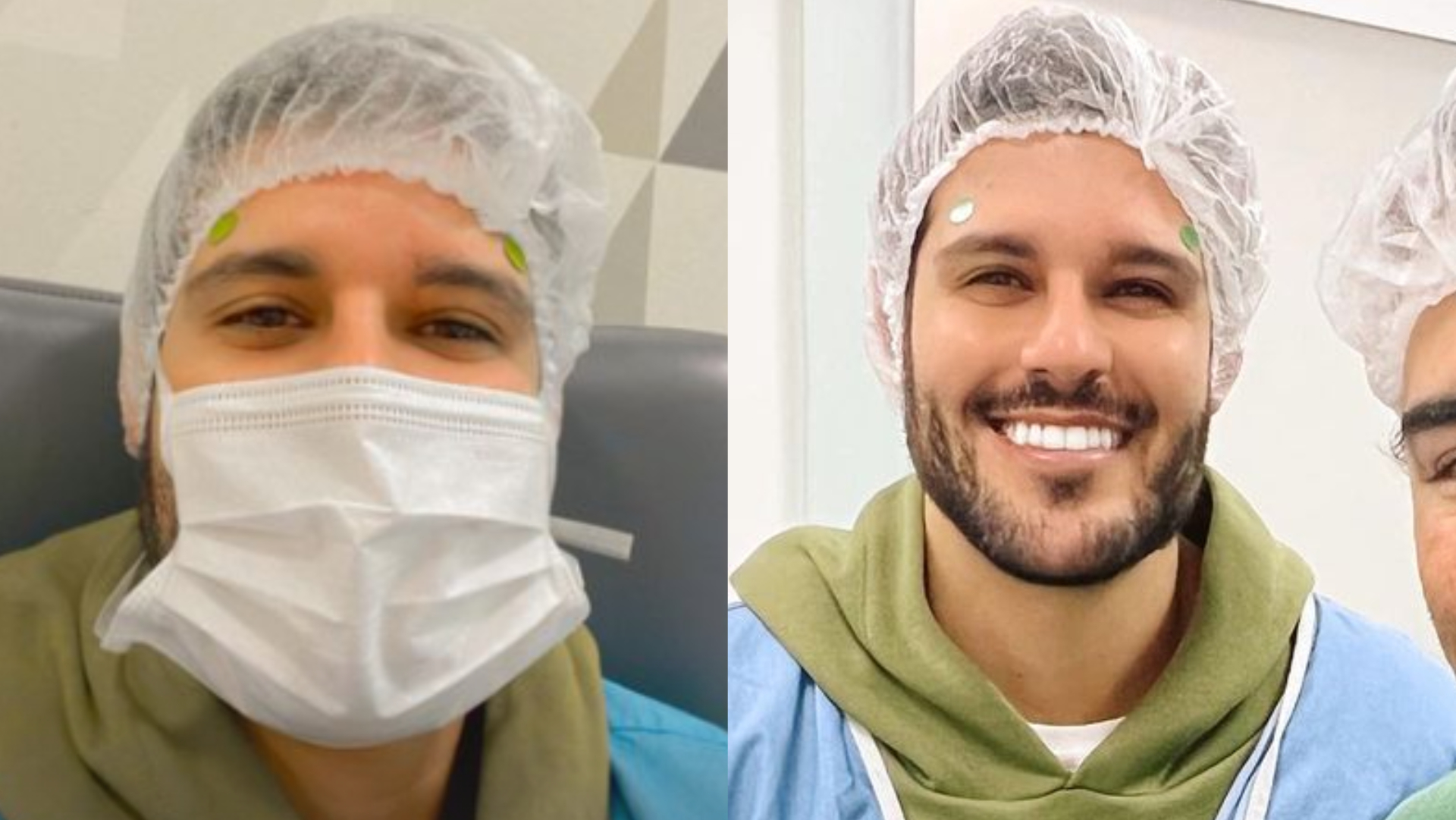 Ex-BBB Rodrigo Mussi passa por cirurgia nos olhos: ”Voltar a enxergar o mundo como ele é”